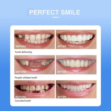 Snap-on Smile For Beautiful Smiles Temporary Comfort Fit Whitening Instant Transformation For Men & Women